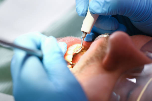 Best Emergency Cosmetic Dentistry in Fayetteville, AR