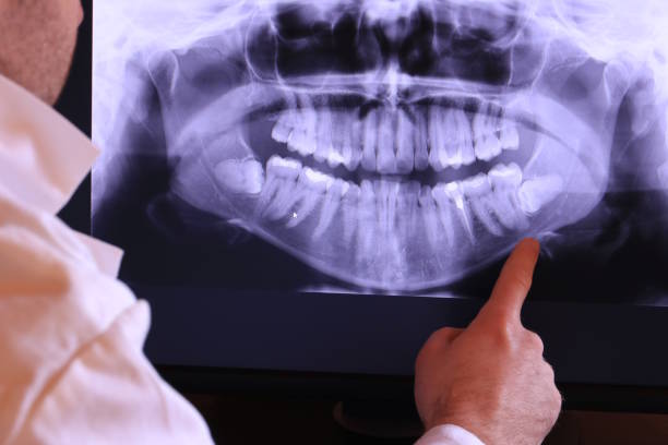Best Emergency Dental Extractions in Fayetteville, AR