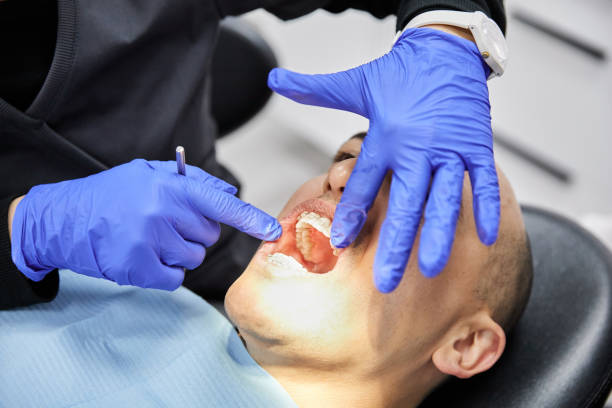 Best Emergency Dentist for Knocked-Out Tooth in Fayetteville, AR